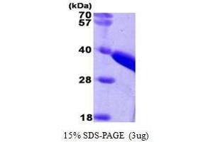 Figure annotation denotes ug of protein loaded and % gel used. (TST Protein (AA 1-297))