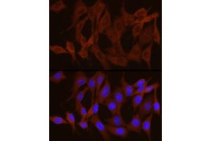 Immunofluorescence (IF) image for anti-phosphorylase, Glycogen, Brain (GPBB) (AA 544-843) antibody (ABIN6146522)
