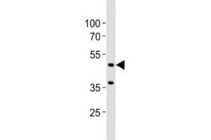 Western blot analysis of lysate from mouse brain tissue lysate using Eed antibody diluted at 1:1000. (EED antibody  (N-Term))