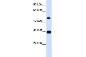 WB Suggested Anti-PSMC3 Antibody Titration: 0.
