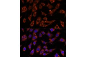 Immunofluorescence analysis of L929 cells using GFPT2 antibody (ABIN7267431) at dilution of 1:100. (GFPT2 antibody  (AA 200-260))