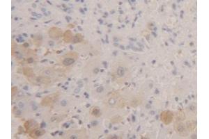 Detection of FABP1 in Human Liver Tissue using Polyclonal Antibody to Fatty Acid Binding Protein 1 (FABP1) (FABP1 antibody  (AA 2-127))
