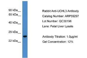 WB Suggested Anti-UCHL3  Antibody Titration: 0. (UCHL3 antibody  (C-Term))