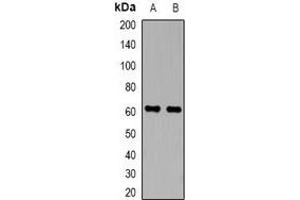 Western blot analysis of Perforin 1 expression in Hela (A), Jurkat (B) whole cell lysates.