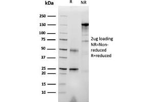 SDS-PAGE Analysis Purified RET Mouse Monoclonal Antibody (RET/2976). (Ret Proto-Oncogene antibody  (AA 702-848))
