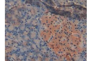 Detection of PDK2 in Mouse Pancreas Tissue using Polyclonal Antibody to Pyruvate Dehydrogenase Kinase Isozyme 2 (PDK2) (PDK2 antibody  (AA 155-379))