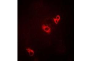 Immunofluorescent analysis of ACAD9 staining in MCF7 cells. (ACAD9 antibody)