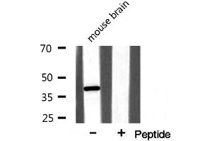 Western blot analysis on mouse brain lysate using NPM Antibody (NPM1 antibody  (N-Term))