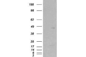 HEK293 overexpressing SKAP2 and probed with ABIN2559830 (mock transfection in first lane). (SKAP2 antibody  (C-Term))