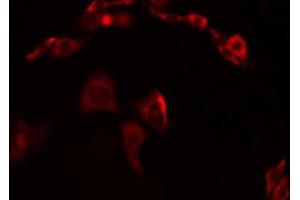 ABIN6274953 staining Hela by IF/ICC. (CHST13 antibody  (Internal Region))