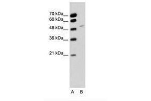 Image no. 1 for anti-RNA Binding Motif Protein 22 (RBM22) (AA 301-350) antibody (ABIN6736326) (RBM22 antibody  (AA 301-350))