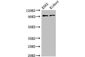 Western Blot Positive WB detected in:K562 whole cell lysate,Mouse kidney tissue All lanes:AP1G1 antibody at 3. (gamma 1 Adaptin antibody  (AA 592-686))