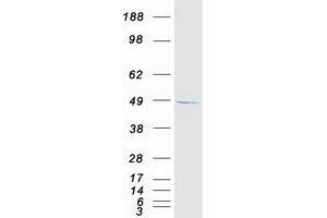 Validation with Western Blot (SDCCAG3 Protein (Transcript Variant 2) (Myc-DYKDDDDK Tag))