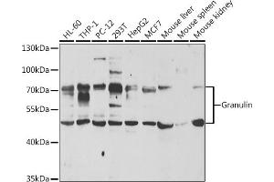 Western blot analysis of extracts of various cell lines, using Granulin antibody (ABIN6131043, ABIN6141430, ABIN6141432 and ABIN6221454) at 1:1000 dilution.