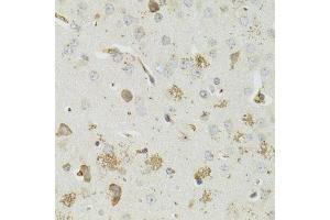 Immunohistochemistry of paraffin-embedded mouse brain using PTPN3 antibody (ABIN5973802) at dilution of 1/100 (40x lens). (PTPN3 antibody)