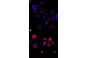 Immunocytochemistry staining of serum-starved A431 cells (A) and serum-starved A431 cells treated with Calyculin A/Okadaic Acid (B) using Phosphothreonine monoclonal antibody, clone RM102  (Red) at 1:500 dilution. (Phosphothreonine antibody)