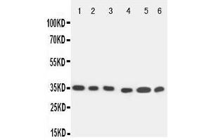 Western Blotting (WB) image for anti-Caspase 9, Apoptosis-Related Cysteine Peptidase (CASP9) (AA 183-198), (Middle Region) antibody (ABIN3044458)