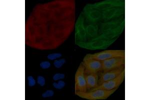 PKC delta Mouse Monoclonal Antibody staining Hela cells by IF/ICC.