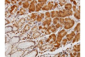 Immunoperoxidase of monoclonal antibody to LIMK1 on formalin-fixed paraffin-embedded human stomach. (LIM Domain Kinase 1 antibody  (AA 548-647))
