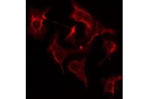 ABIN6275202 staining COLO205 cells by IF/ICC. (AASDHPPT antibody  (C-Term))