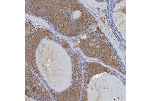 IHC analysis of mSin3A/SIN3A using anti-mSin3A/SIN3A antibody (ABIN7602504). (SIN3A antibody  (AA 8-918))