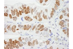 Immunohistochemistry (IHC) image for anti-H2A Histone Family, Member X (H2AFX) (C-Term) antibody (ABIN7448589)