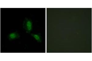 Immunofluorescence analysis of HeLa cells, using IRS-1 (Ab-312) Antibody. (IRS1 antibody  (AA 279-328))