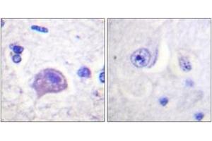 Immunohistochemistry analysis of paraffin-embedded human brain tissue, using HRS (Ab-334) Antibody. (HRS (HRS) (AA 301-350) antibody)