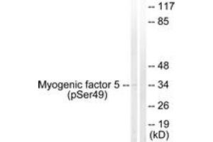 Western blot analysis of extracts from HeLa cells, using Myogenic Factor 5 (Phospho-Ser49) Antibody. (MYF5 antibody  (pSer49))