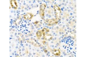 Immunohistochemistry of paraffin-embedded Mouse kidney using CST4 Polyclonal Antibody at dilution of 1:100 (40x lens). (CST4 antibody)