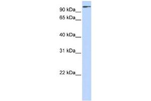 WB Suggested Anti-ZNF175 Antibody Titration:  0.