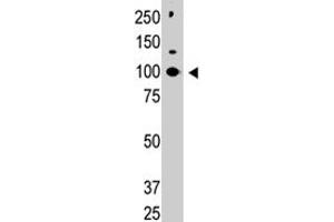 Western blot analysis of CBLC polyclonal antibody  in HL-60 cell lysate. (CBLC antibody  (C-Term))