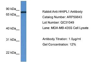 WB Suggested Anti-HHIPL1  Antibody Titration: 0.