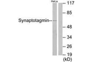 Western Blotting (WB) image for anti-Synaptotagmin (SYT) (AA 176-225) antibody (ABIN2888581) (Synaptotagmin antibody  (AA 176-225))