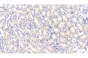 Immunohistochemistry (IHC) image for anti-Pregnancy Zone Protein (PZP) (AA 1251-1500) antibody (ABIN7438814)