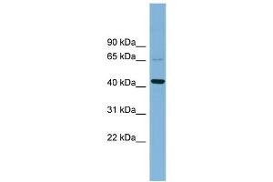 WB Suggested Anti-UEVLD  Antibody Titration: 0. (UEVLD antibody  (Middle Region))