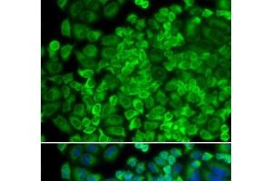 Immunofluorescence analysis of HeLa cells using GLA Polyclonal Antibody (GLA antibody)