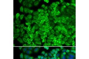 Immunofluorescence analysis of HeLa cells using GLA Polyclonal Antibody (GLA antibody)