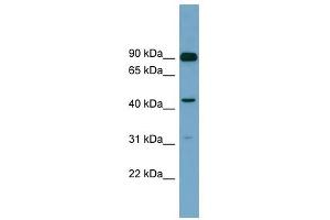 DGKA antibody used at 1 ug/ml to detect target protein. (DGKA antibody  (N-Term))