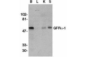 Western Blotting (WB) image for anti-GDNF Family Receptor alpha 1 (GFRA1) antibody (ABIN2473776) (GFRA1 antibody)
