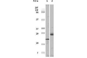 Western Blot showing 4E-BP1 antibody used against truncated 4E-BP1 recombinant protein (1) and A431 cell lysate (2). (eIF4EBP1 antibody)