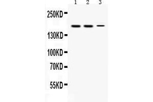 Western blot analysis of KDM5B expression in rat testis extract ( Lane 1), mouse testis extract ( Lane 2) and HEPG2 whole cell lysates ( Lane 3). (KDM5B antibody  (Middle Region))