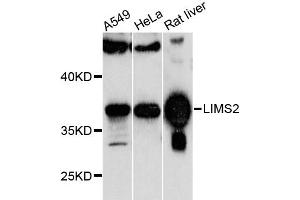 Western blot analysis of extracts of various cell lines, using LIMS2 antibody (ABIN6293255) at 1:1000 dilution. (LIMS2 antibody)