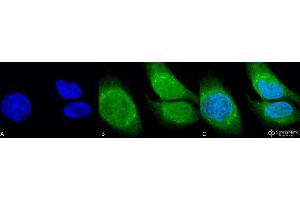 Immunocytochemistry/Immunofluorescence analysis using Rabbit Anti-GRP78 (Bip) Polyclonal Antibody . (GRP78 antibody  (N-Term) (PerCP))