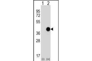 Western blot analysis of CTSK (arrow) using rabbit polyclonal CTSK Antibody (Center ) (ABIN656812 and ABIN2846026). (Cathepsin K antibody  (AA 97-126))