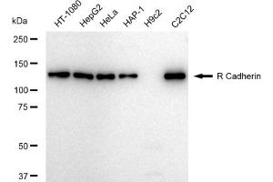 Western blotting analysis using R Cadherin antibody (ABIN7797822).