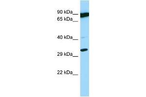 Host: Rabbit Target Name: PSMB11 Sample Type: OVCAR-3 Whole Cell lysates Antibody Dilution: 1. (PSMB11 antibody  (C-Term))