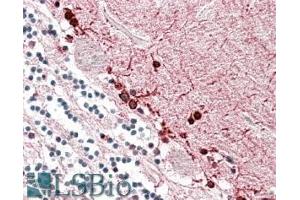 ABIN571185 (3. (ALDH9A1 antibody  (Internal Region))