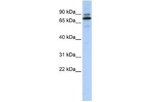 WB Suggested Anti-C14orf21 Antibody Titration:  0. (C14orf21 antibody  (Middle Region))
