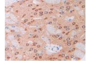 IHC-P analysis of Rat Brain Tissue, with DAB staining. (HGF antibody  (AA 306-471))